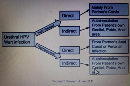 Urethral HPV Warts & Tumors – photo 12